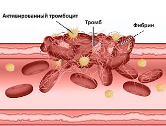 При приеме Ксефокама Рапид необходим контроль со стороны свертываемости крови