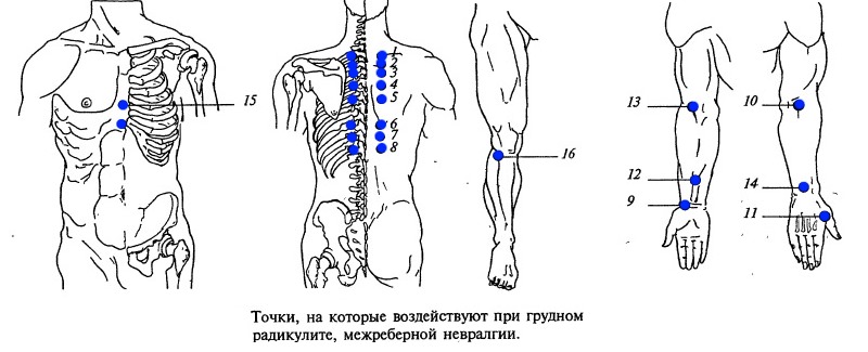 Точки, на которые воздействуют при торакалгии