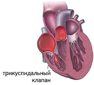 как выглядит клапан сердца