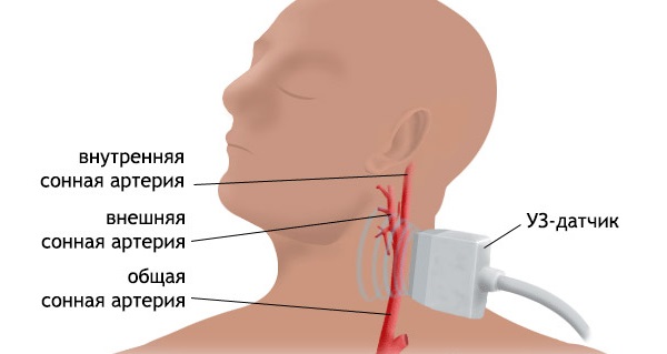 Триплексное сканирование представляет из себя трехмерное исследование