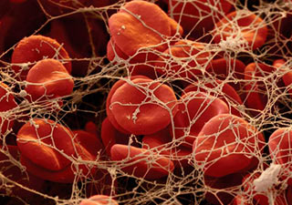 тромбоциты