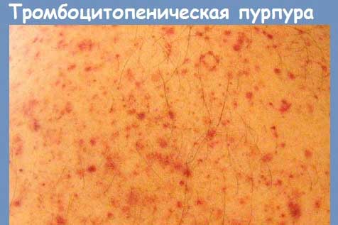 красные точки на кожном покрове