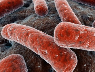 Возбудителями заболевания являются различные бактерии