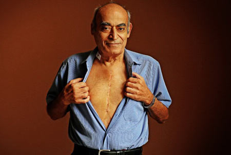 у мужчины шрам на груди