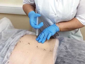 Обратите внимание как правильно делать инъекции при поясничном остеохондрозе