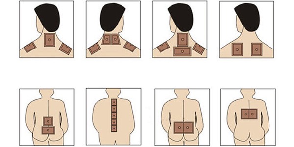 Место установки пластыря зависит от локализации проблемы