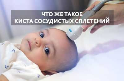 УЗИ новорожденного