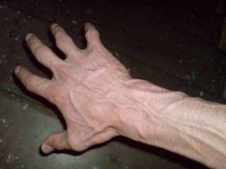 вены на руке