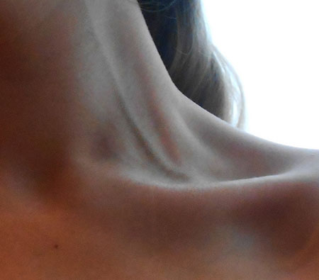 вены на шее