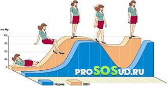 венозная недостаточность