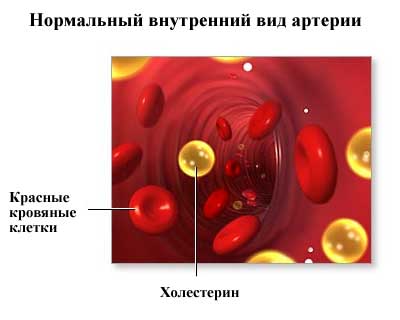 внутренний вид артерии
