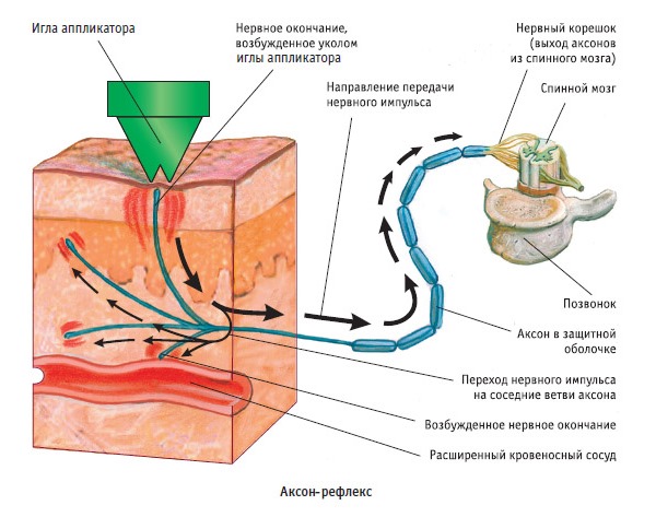 Принцип действия аппликаторов основывается на воздействии на рефлекторные точки