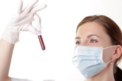 врач смотрит на анализ крови