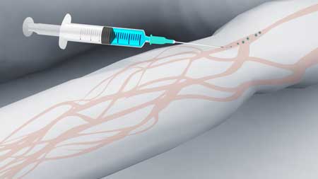 введение контрастного вещества