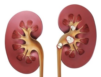 При мочекаменной болезни дозировку препарата назначает только врач