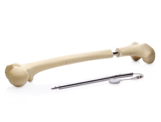 Ученный утверждает, что с новым методом можно менее болезненно выполнять процедуру удлинения костей