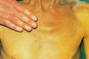 желтая кожа