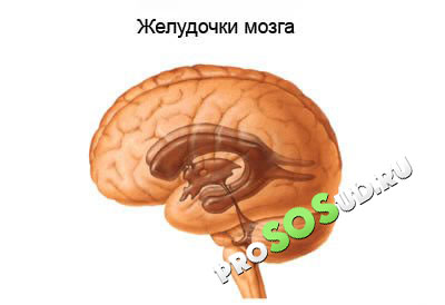 желудочки головного мозга