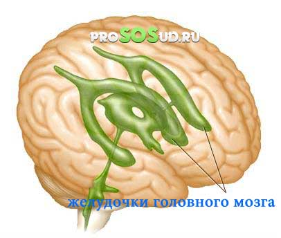 желудочки головного мозга