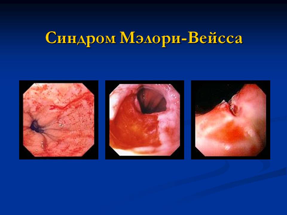 Диагностика желудка