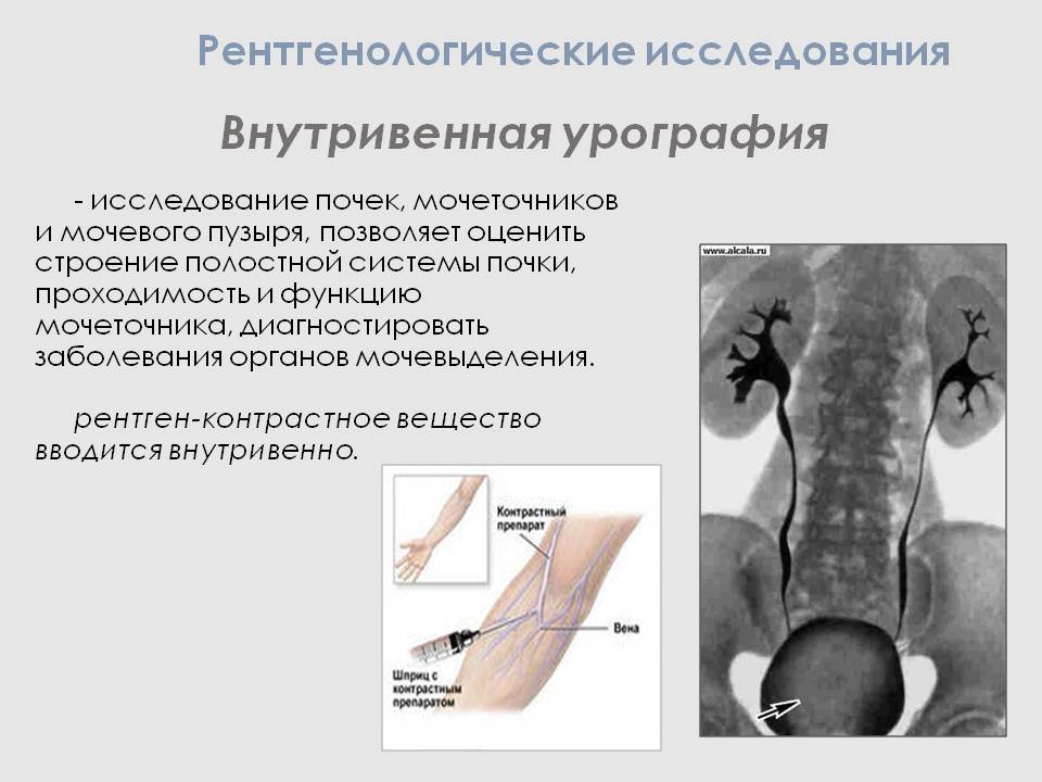 Контрастная урография