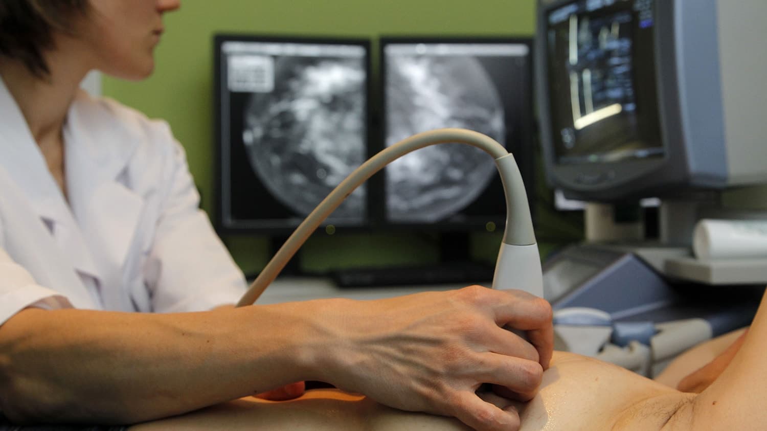 узи молочных желез узи молочных желез