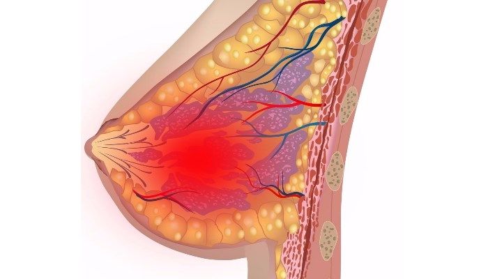 Воспаление