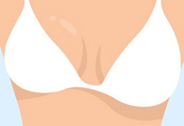 несимметричная грудь несимметричная грудь