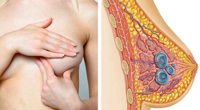 пальпация груди пальпация груди