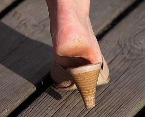 натоптыши на подошве фото