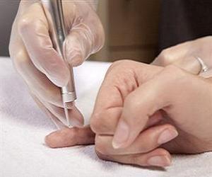 как вывести бородавки фото