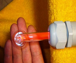 физиотерапия дарсонвализация