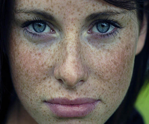 веснушки на лице фото