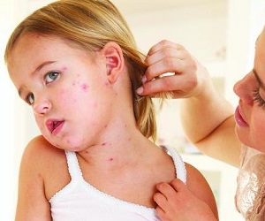 как выглядит чесотка у детей фото