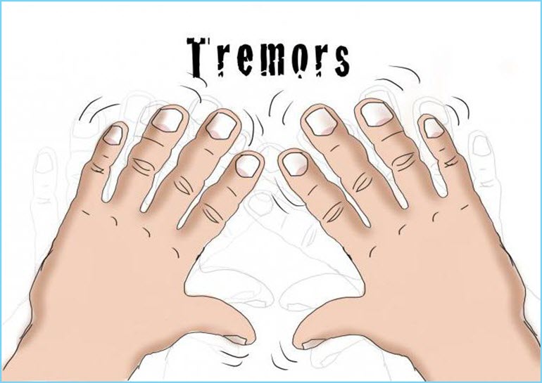 Тремор рук
