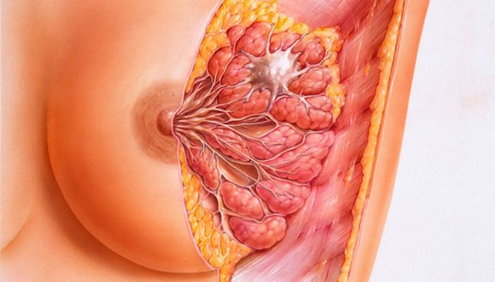 Заболевание молочных желез