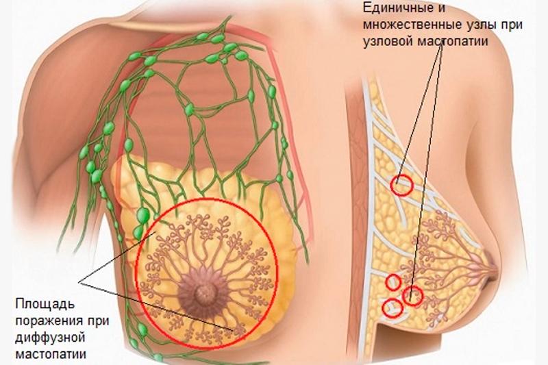 Причины развития болезни Причины развития болезни