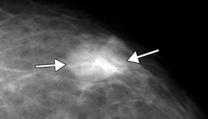 Новообразование