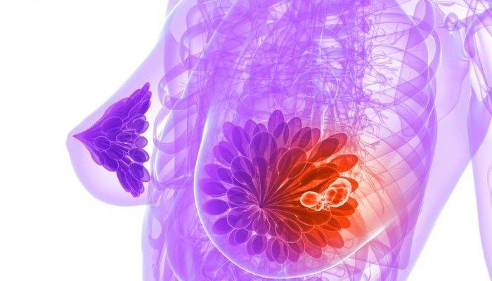 Женская грудь