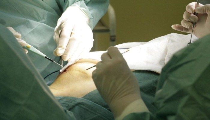 Оперативное вмешательство