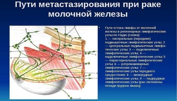 Пути метастазирования при РМЖ