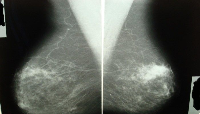 Рентгеновский снимок