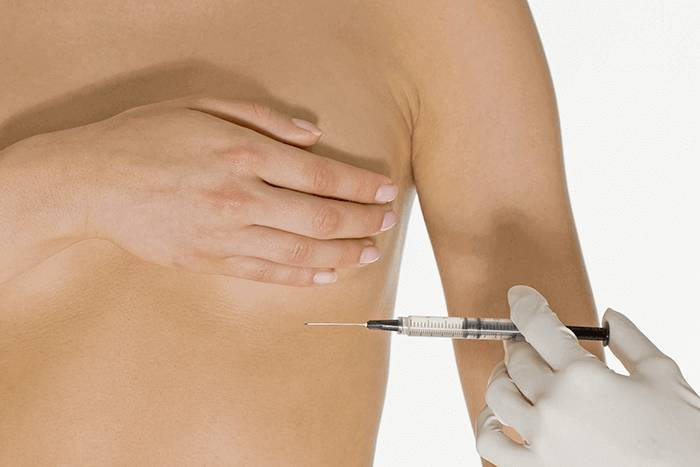 Мезотерапия груди