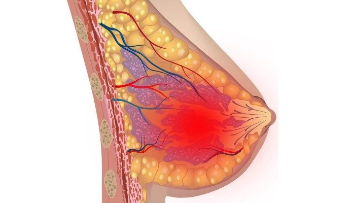 Воспаление в железе