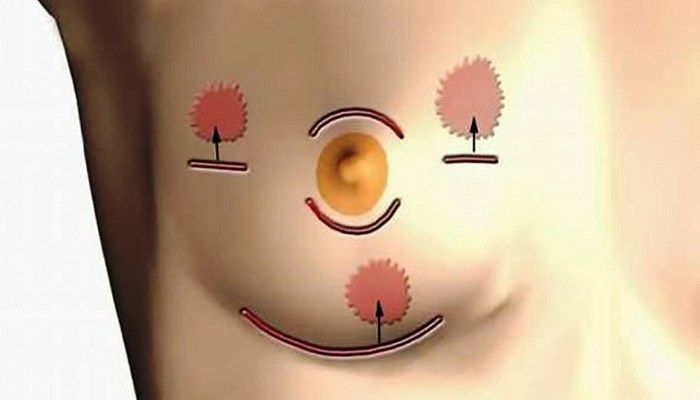 Очаги заболеваний в МЖ