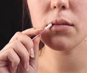 лечение герпеса на губах при беременности