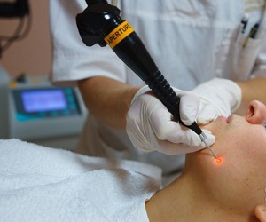 диспластический пигментный невус