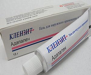 прыщи на лбу лечение фото