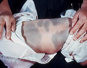 монгольское пятно фото