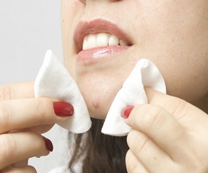 о чем говорят прыщи на подбородке